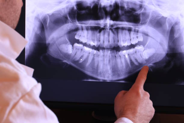 Best Emergency Tooth Extraction in Palm Valley, FL