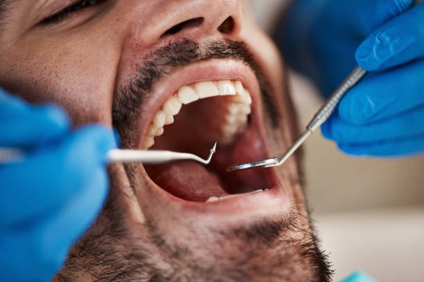 Best Emergency Denture Repair in Palm Valley, FL