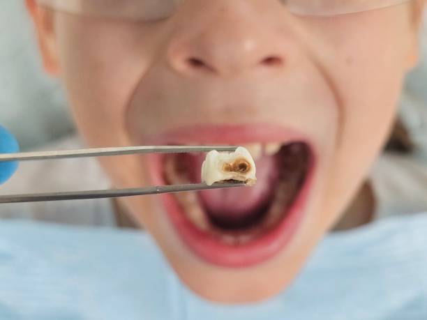 Best Pediatric Emergency Dentist in Palm Valley, FL
